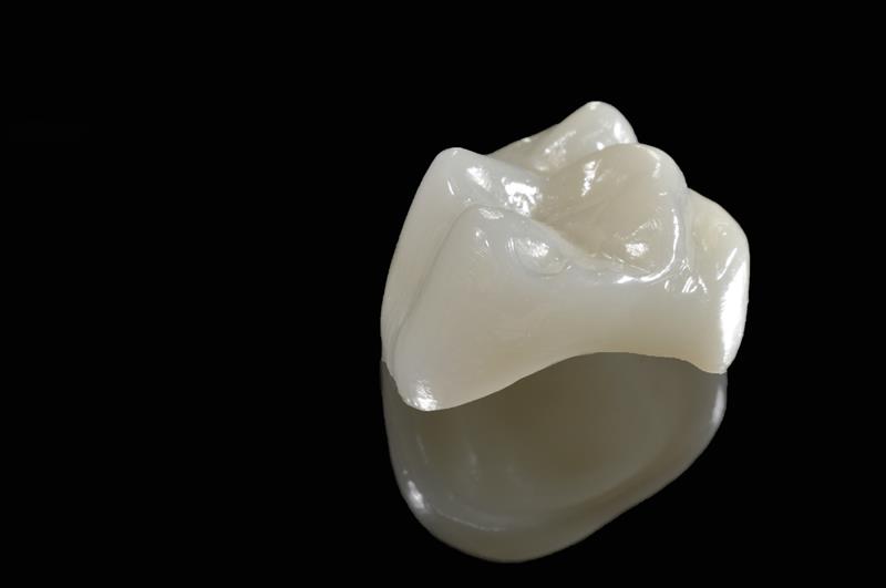 Crown Lengthening